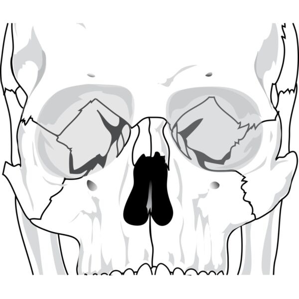 liftarn Human skull 2 Thumbnail