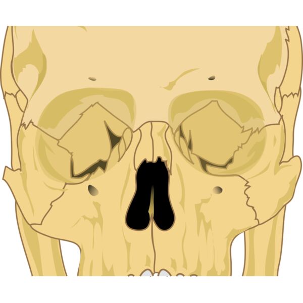 liftarn Human skull Thumbnail